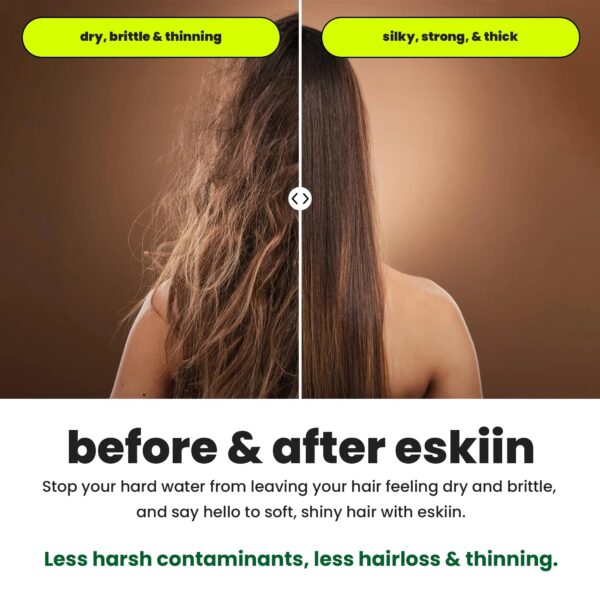 Eskiin Filtered Showerhead With Filters For Healthy Hair & Skin